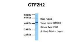 GTF2H2 Antibody, Novus Biologicals 100 &mu;L; Unconjugated:Antibodies,